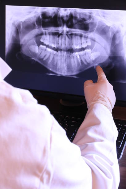 Best Broken or Cracked Tooth Emergency Dentist in Oak Ridge, NJ